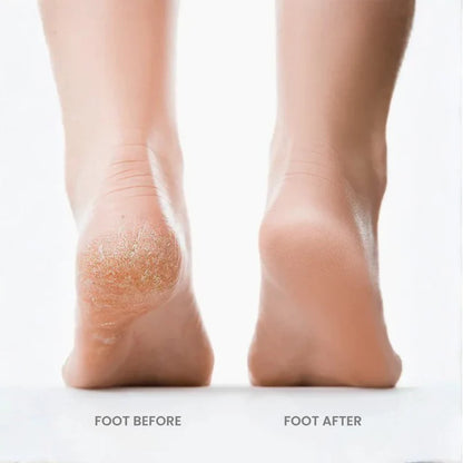 Velnuva Foot Grinder